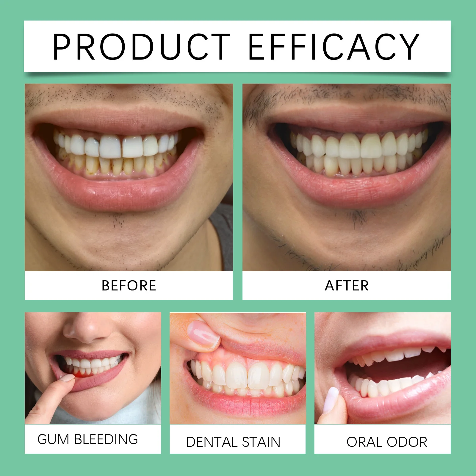 Mild Gum Care Gel Teeth Whitener Improves Gum Health For Inflammation Cleans Teeth and Removes Tea Stains Natural tooth Gel