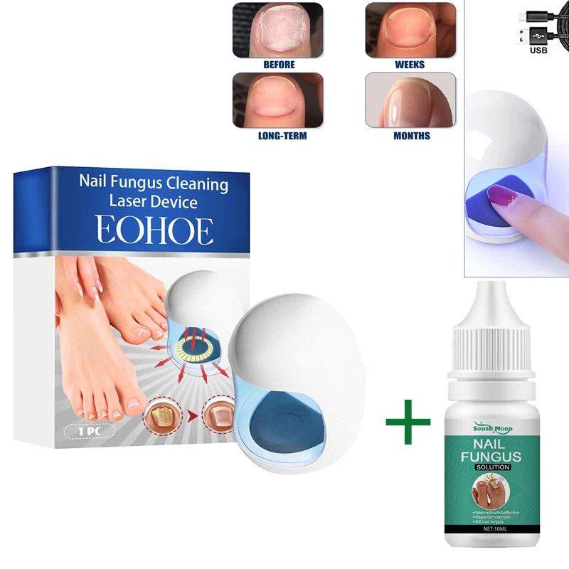 Nail Fungus Laser Treatment Device Fungal Treatment Anti Infection