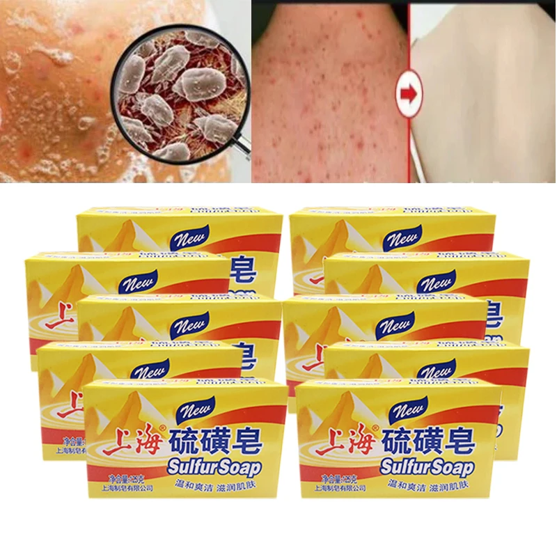 

10pcs Shanghai Sulfur Soap Body Antipruritic Cleansing Healthy Care Soaps For Bath Oil-Control Acne Eczema Anti Fungus Dressing