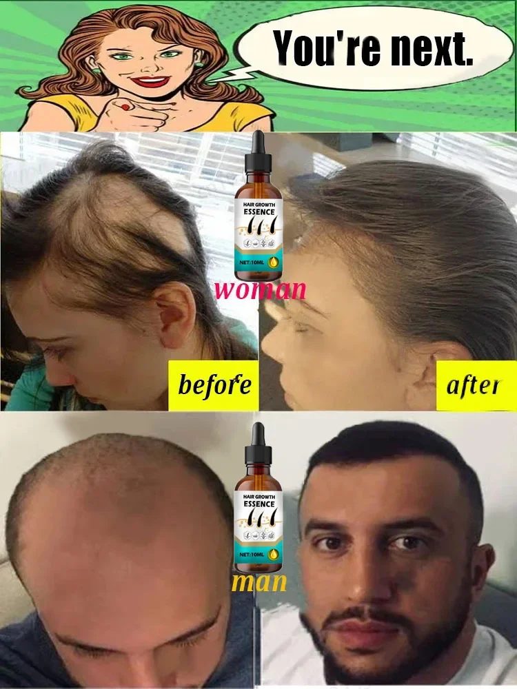 Green bottle. Essential for air growth. Say goodbye to the children. The secret of thick hair growth essence