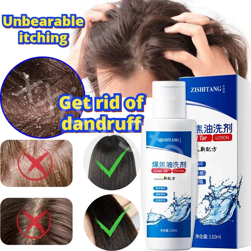 

110ml Coal Tar Lotion Oil Control Anti-dandruff Anti-itch Shampoo Soothing Scalp Antibacterial Liquid Anti-mite Shampoo