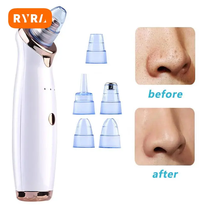 

Blackhead Remover Easy And Convenient To Use Deeply Cleanses Pores Gentle On The Skin Visible Improvement Saves Time And Money