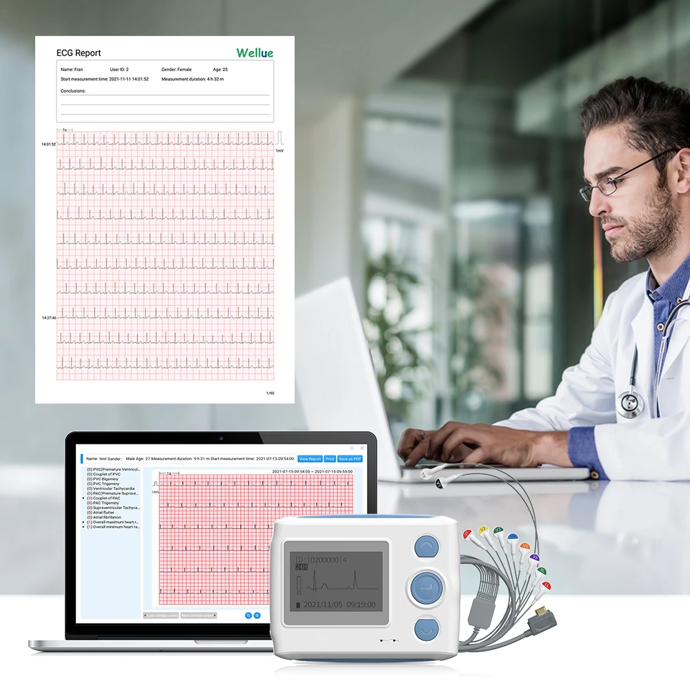 Wellue TH12 12 Lead Holter Recorder Ai Analysis Intelligently Identifies 25 Heart Abnormalities 24-hour Home Ecg Monitoring