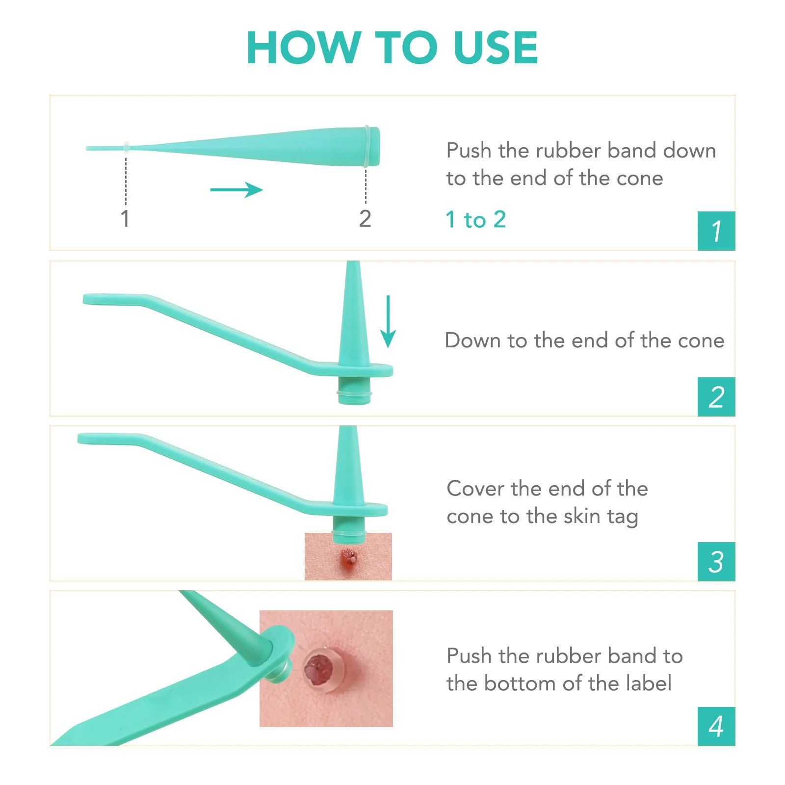 Skin Tag Removal Care Products Simple Wart Removal Tool Set Skin Tag Removeal Tool Easy To Clean Care