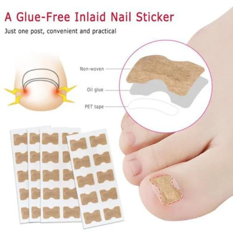 10Pcs Toenail Correction Sticker Foot Care Kit Ingrown Toenail Corrector Pedicure Tool Treatment Recover Corrector Pedicure Tool