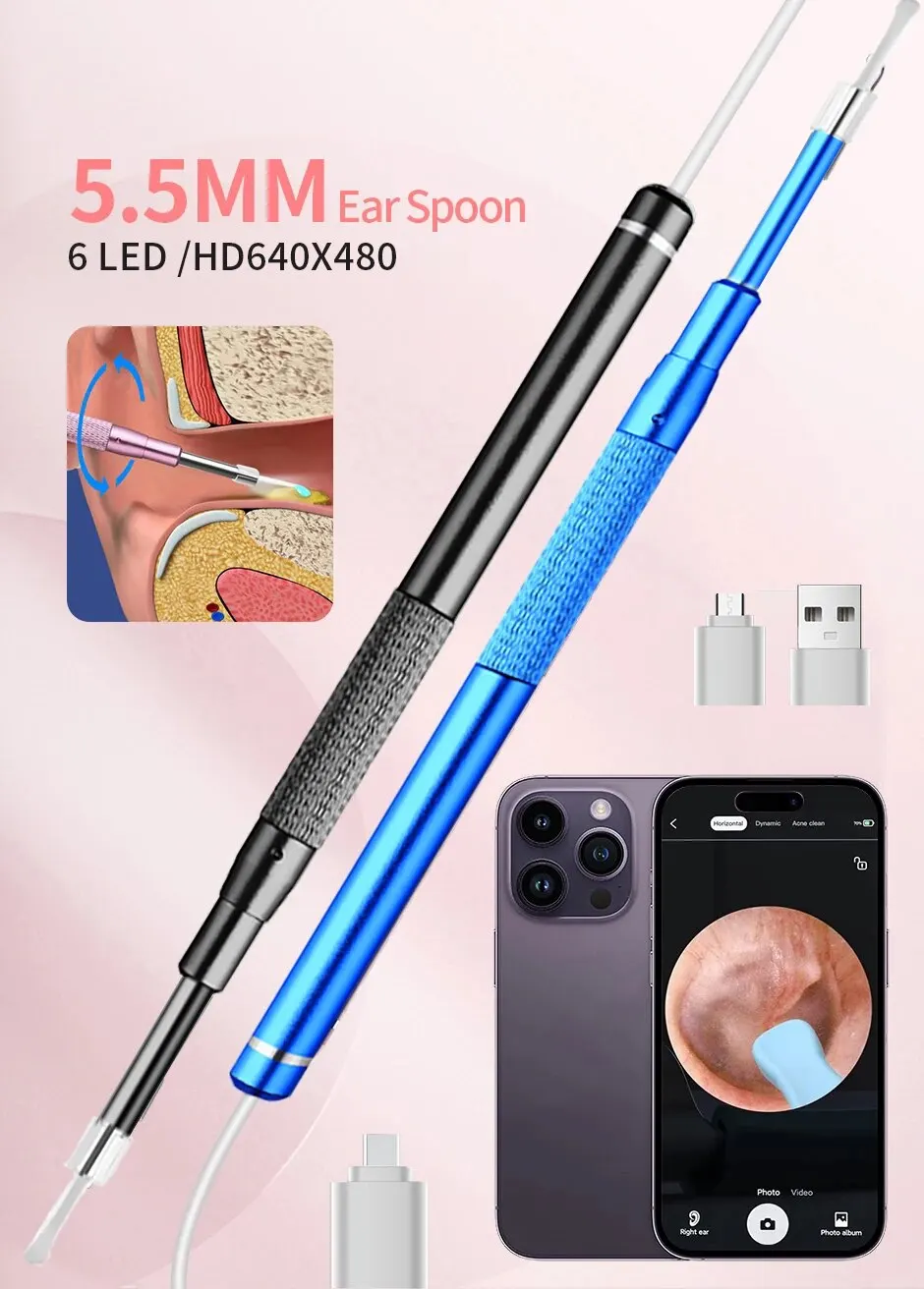 Sf88dd04653854f5792fbcf1f1bb3aaf8F 5.5MM, HD, Visual Ear Endoscope 3 in 1 USB Otoscope Ear Wax Removal HD Endoscope Mini Camera Otoscope Health Care For PC Android Mallzona