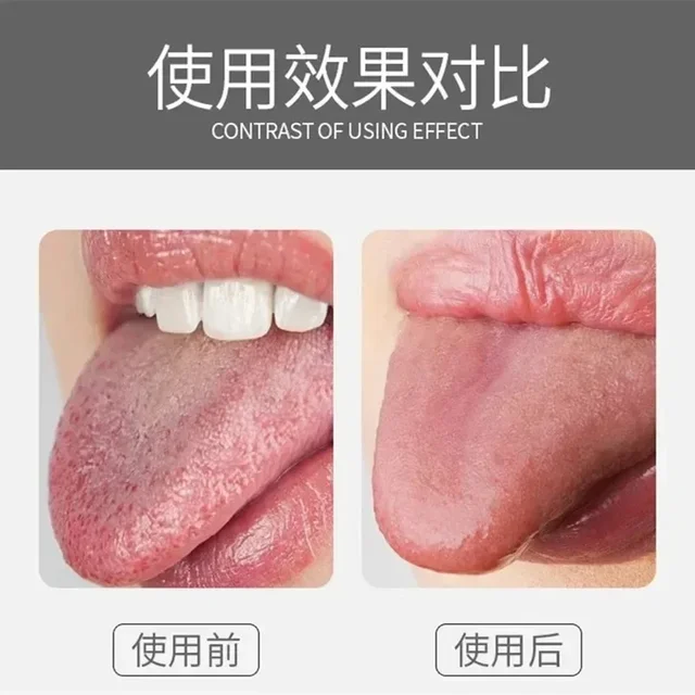 Tongue Scraper PP material /Stainless Steel Tongue Cleaner Bad Breath Removal Oral Care Tools 2