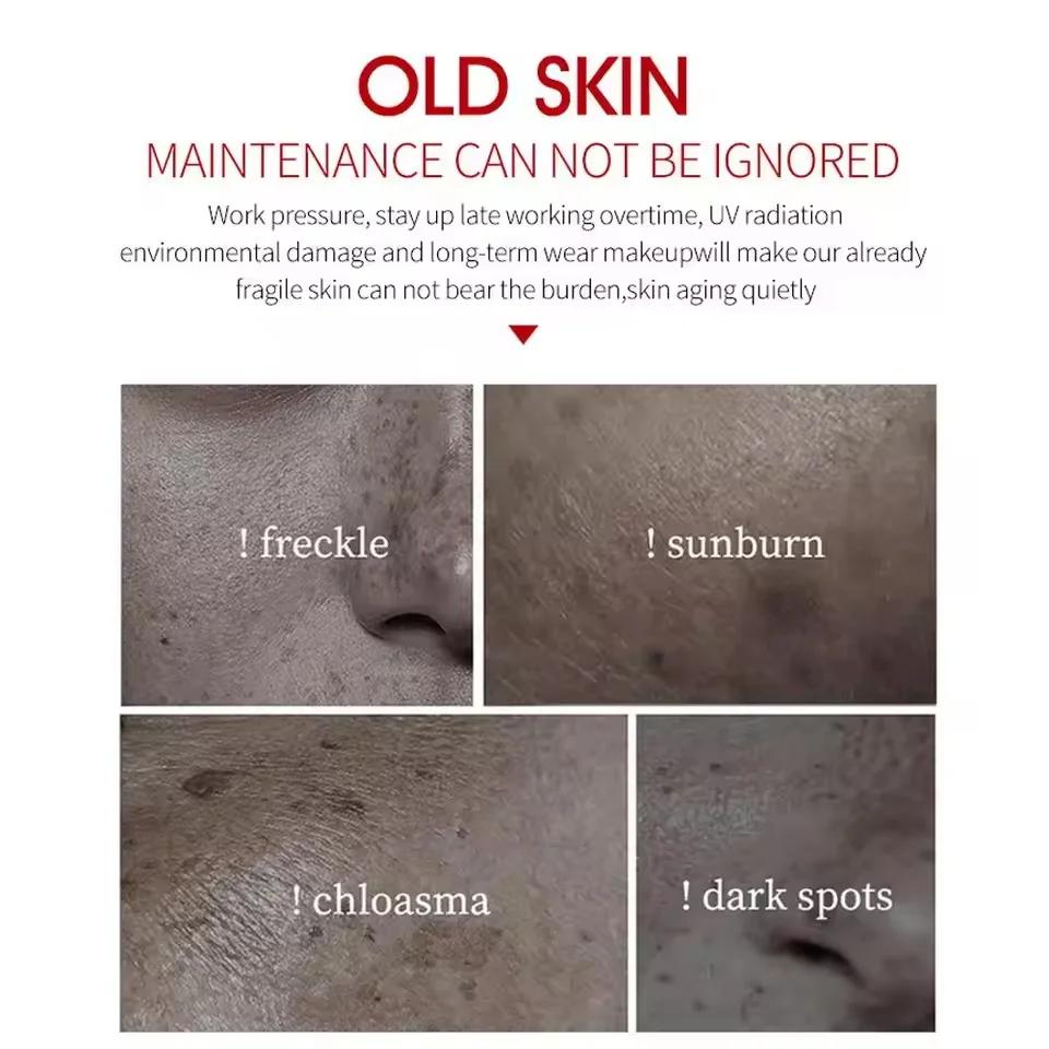 Fades Freckle Dark Spots Face Cream Niacinamide Whitening Cream Vitamin E Improve Dullness Fast Brighten Nourish Skin Care whitening body cream niacinamide serum facial cream