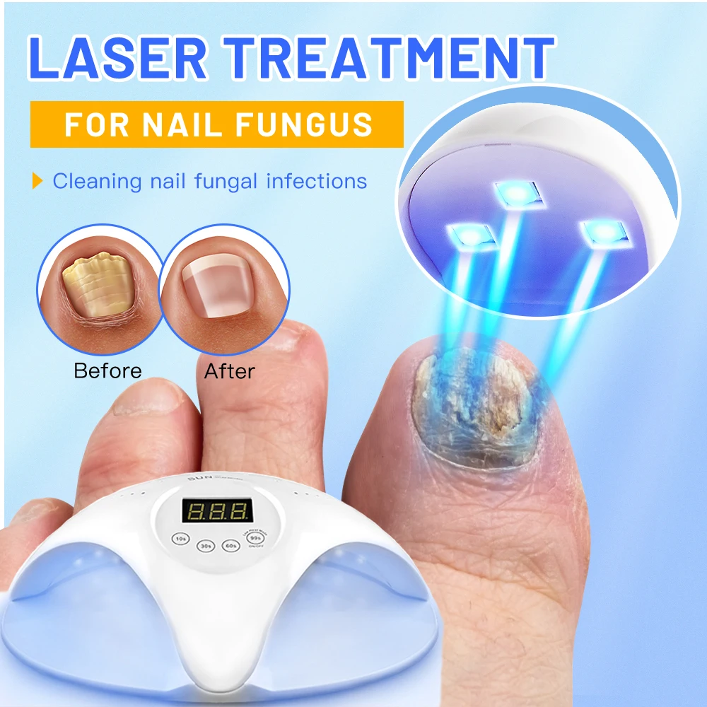 2-In-1 Fungal Nail Laser Device Repair Fast Nails Fungus Onychomycosis Repair Toenail Fingernail Removes Nail Fungus Foot Care nail fungus remover,laser therapy pen