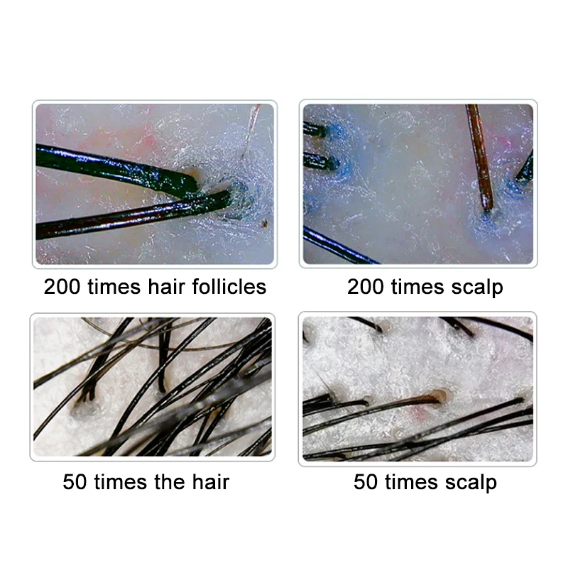 10 Inch LCD Skin&Hair Scalp Analyzer Detector Digital Microscope Magnifier Skin Hair Blackhead Follicle Detection 50X-200X facial skin analyzer