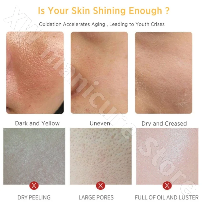Herbal Hyaluronic Acid Moisturizing Milk Relieves Dry Skin, Acne Muscle and Improves Facial Hemorrhage 110g