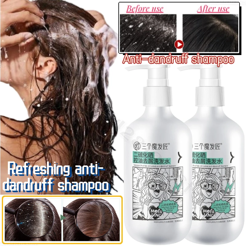 

Refreshing Oil Control Anti-dandruff Shampoo Moisturizing and Repairing Damaged Scalp Shampoo Deep Cleansing Hair Follicles