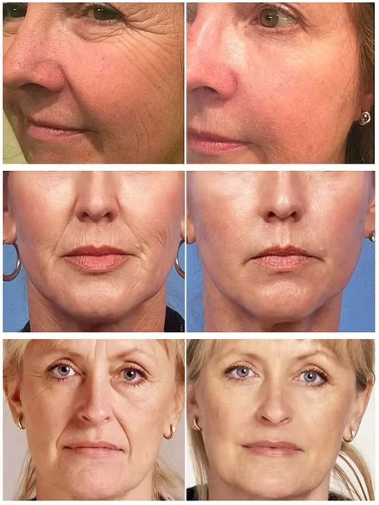 Wrinkle Remove Dragon Blood Cream Whitening Moisturizing Repair Cosmetics Anti-aging Women Face Beauty Nourish Skin Care Product face cream skin cream