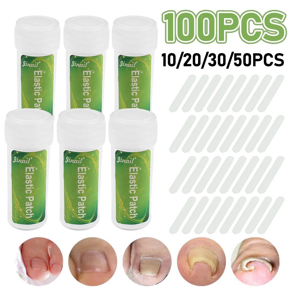 Ingrown Toenail Correction Tool Ingrown Toe Nail Treatment Elastic Patch Sticker Straightening Clip Corrector 10-100PCS/Bottle ingrown toenail corrector
