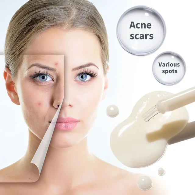 Pure Tea Tree Oil Moisturizer