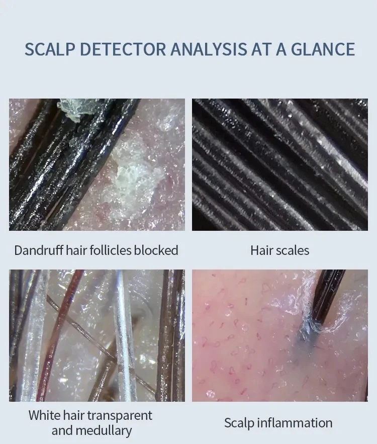 Portable Skin Analyzer Scalp Hair Camera Scanner Wireless Wifi Connection Compatible With Android IOS System