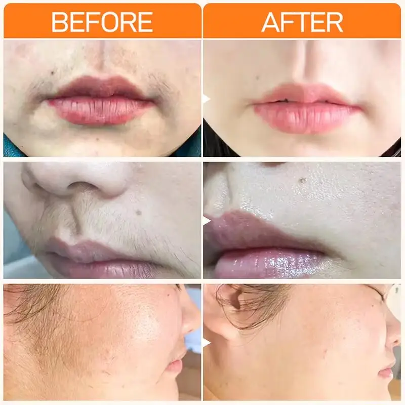 Painless Hair Removal Cream Gentle Removal Skin Care Whitening Lip Hair Underarm Depilation Cream For Women Beauty