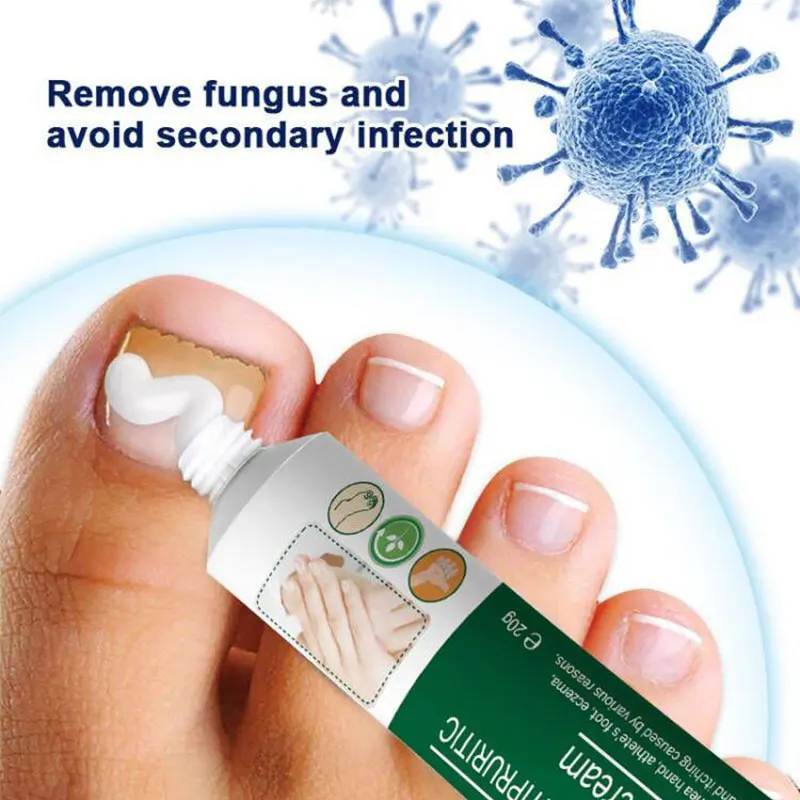 Herbal Foot Fungus Removal Cream Nail Care Ointment Anti Fungal Infection Onychomycosis Paronychia Toe Fungus Repair