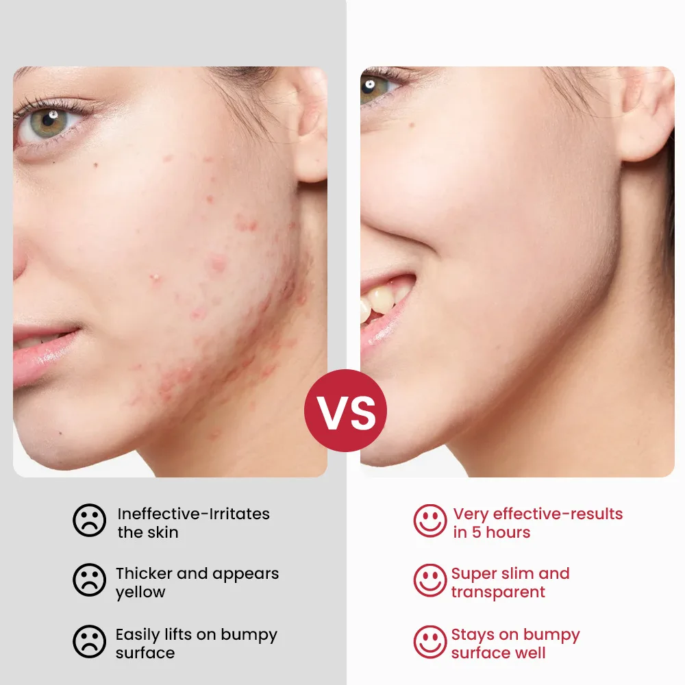 Skin Care , facial, skin care,Sumifun， Adolescence， Antibacterial Cream, Acne Cream 20g
