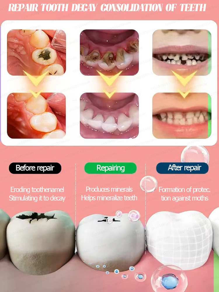 Probiotic Toothpaste Solves Tooth Gum Pain Prevents Dental Problems Whitens Teeth