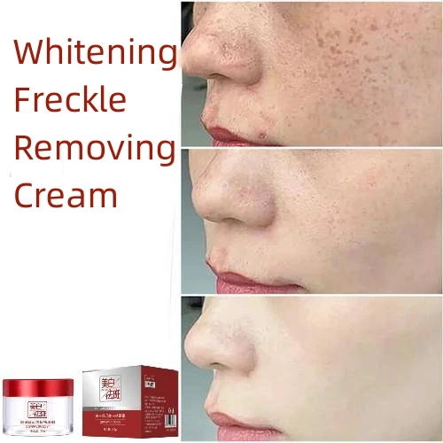 

Whitening Freckle Cream Remove Dark Spots Anti Freckle Face Creams Niacinamide Fade Pigmentation Melasma Brighten Skin Care 50g