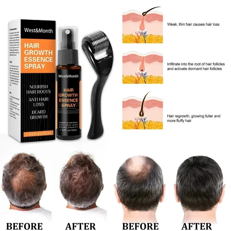 Hair Growth Care Ginger Polygonum Multiflorum Anti-Hair Loss Hair Care Essence Oil Unisex Fast Growth Thick Spray