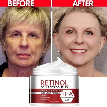 Retinol Wrinkle Removal Face Cream Firming Lifting Anti Aging Fade Fine Lines Moisturizing Whitening Brighten Smooth Skin Care