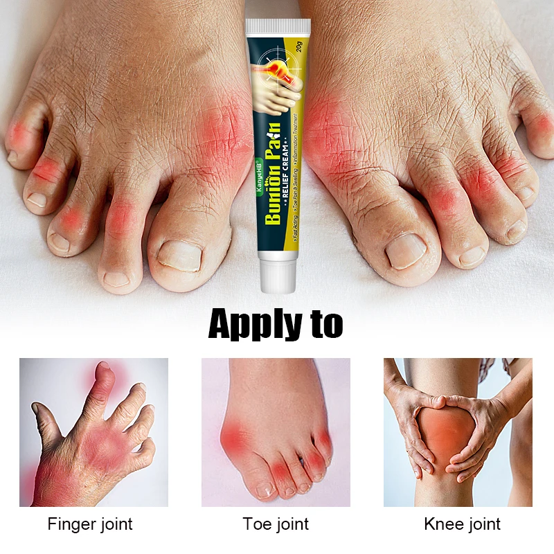 1Pcs Foot Gout Cream Arthritis Bone Thumb Corrector Finger Hallux Toe Bunion Joint Pain Relief Herbal Medical Care Ointment G049 knee pain relief cream pain relief cream skin care ointment
