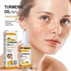Turmeric Remove Dark Spots Essential Oil Anti wrinkle Serum 100% Pure Therapeutic Grade Face Whitening Moisturizing Skin Care 2