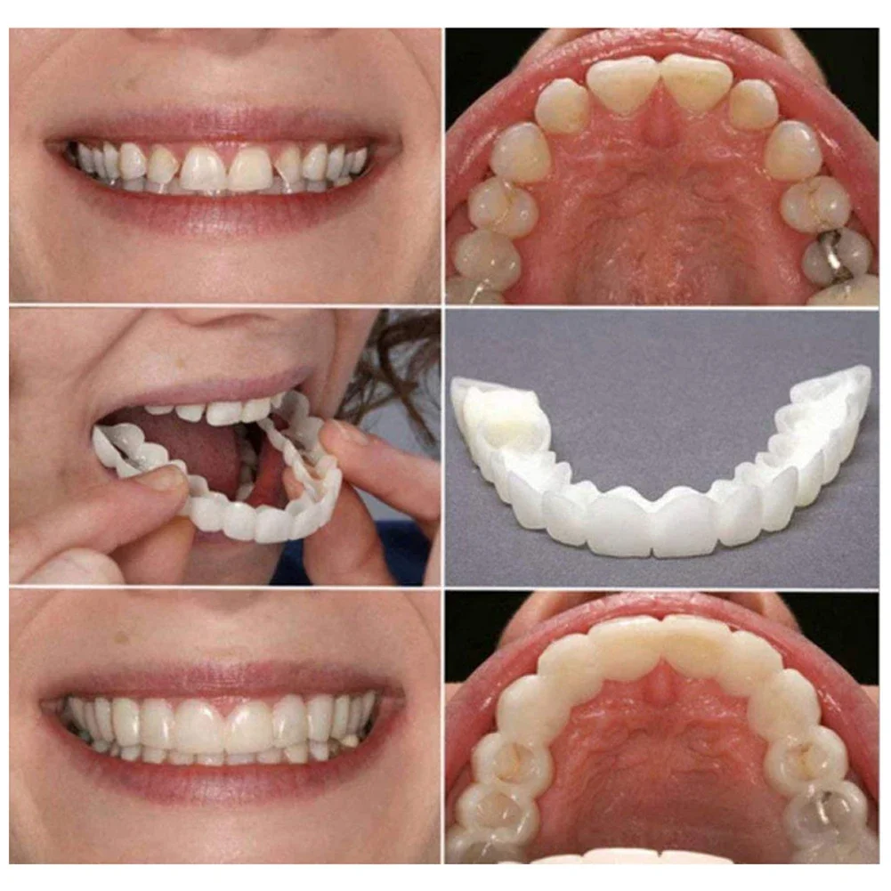 2 Pairs Smile Whitening Teeth Snap Cap Denture Care Whitening Alternative Smile Snap Tooth Perfect False Teeth for Men and Women