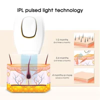 Épilateur laser indolore à flash rapide pour femme, photoépilateur en continu, traitement du corps entier, épilation Ipl, 999900 3