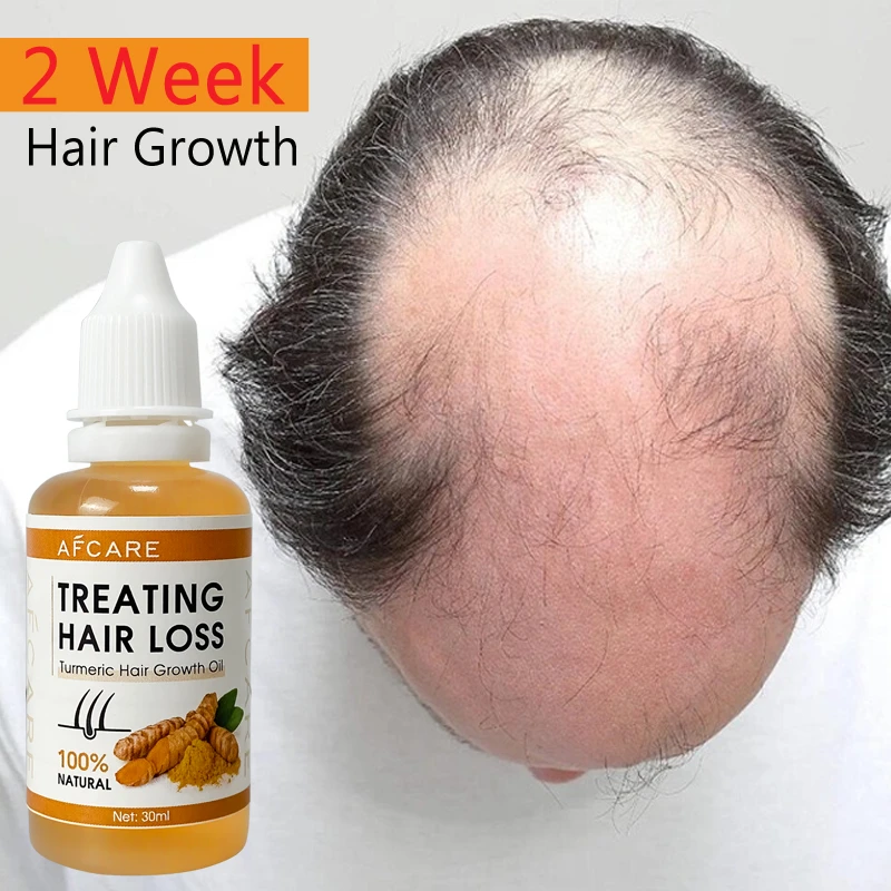 Strong Effect Turmeric Hair Growth Products Ginger Essential Oil 2 Week