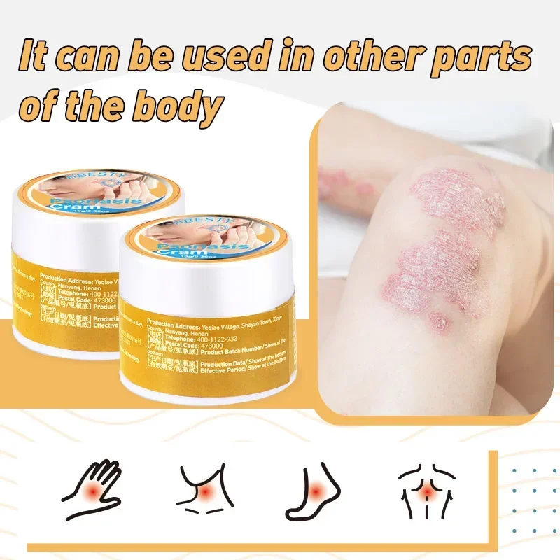 Herbal Anti-itch Psoriasis Treatment Ointment Eczema Hand Foot Tinea Against Fungi Itching Dermatitis Skin antipruritic Cream