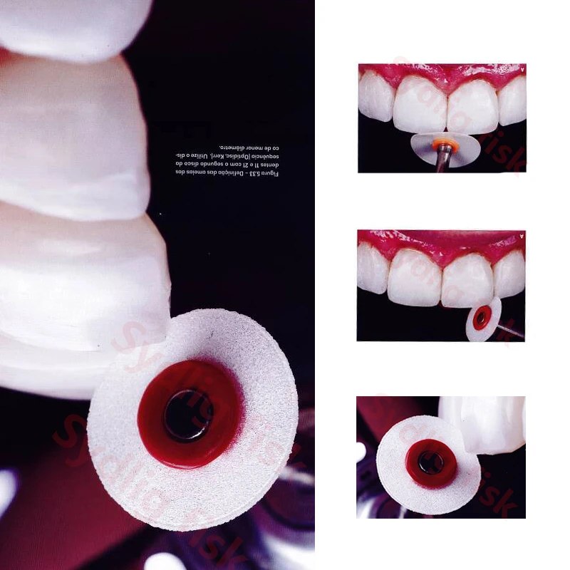 EASYINSMILE KIT STELO Finitura Composita Dentale 40 Pz E Mandrino EUR - Foto 6