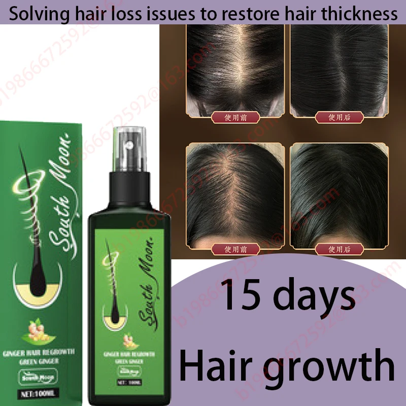 

Hair growth oil, rapid hair growth, effective baldness repair, hereditary hair loss, postpartum hair loss, seborrheic alopecia