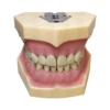 Frasaco AG3 Typodont Fit Dental 32Pcs Screw-in Teeth Model Practice Filling Standard Restoration Demo M8014-2-1 Teach Study 2