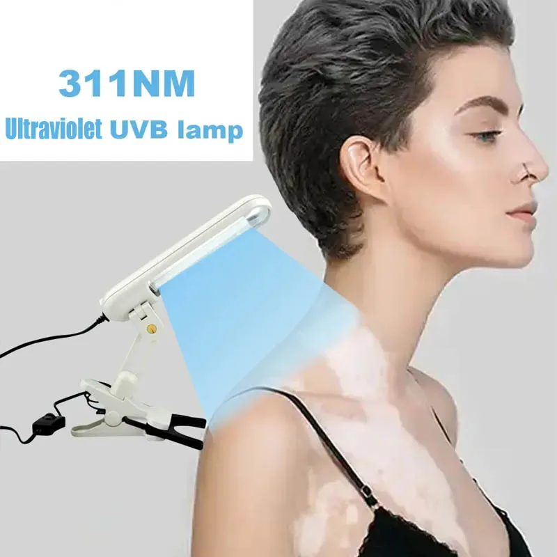 UvbPhototherapyNarrow311nmUvPhototherapyLampUvbLightTherapy
