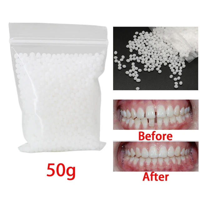 50G Temporary Tooth Solid Glue False Teeth Moldable Denture White Thermal  Beads - AliExpress