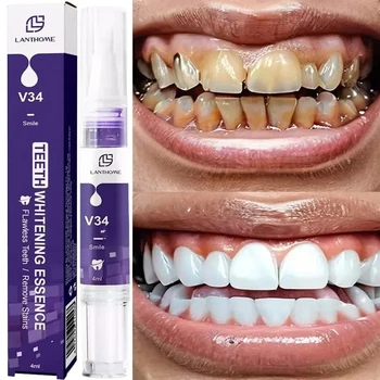 Penna sbiancante magica per denti, rimuove efficacemente la placca dentale, le macchie di caffè e di fumo, rinfresca l'alito, cura e sbianca i denti