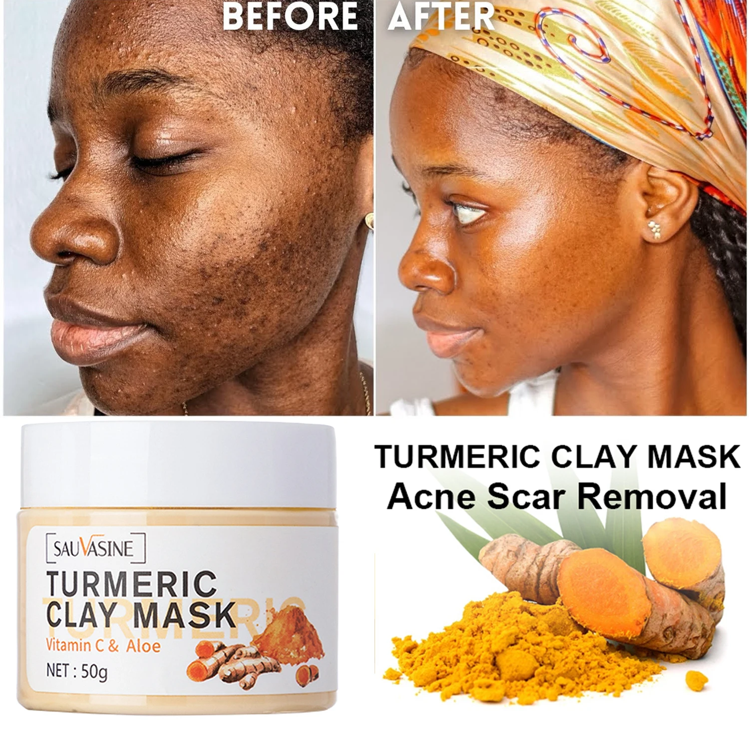 Turmeric Extract Mud Mask Facial Cleansing Blackheads Skin Lightening Care Brighten Vitamin C Turmeric Clay Glow Mask Masks - AliExpress