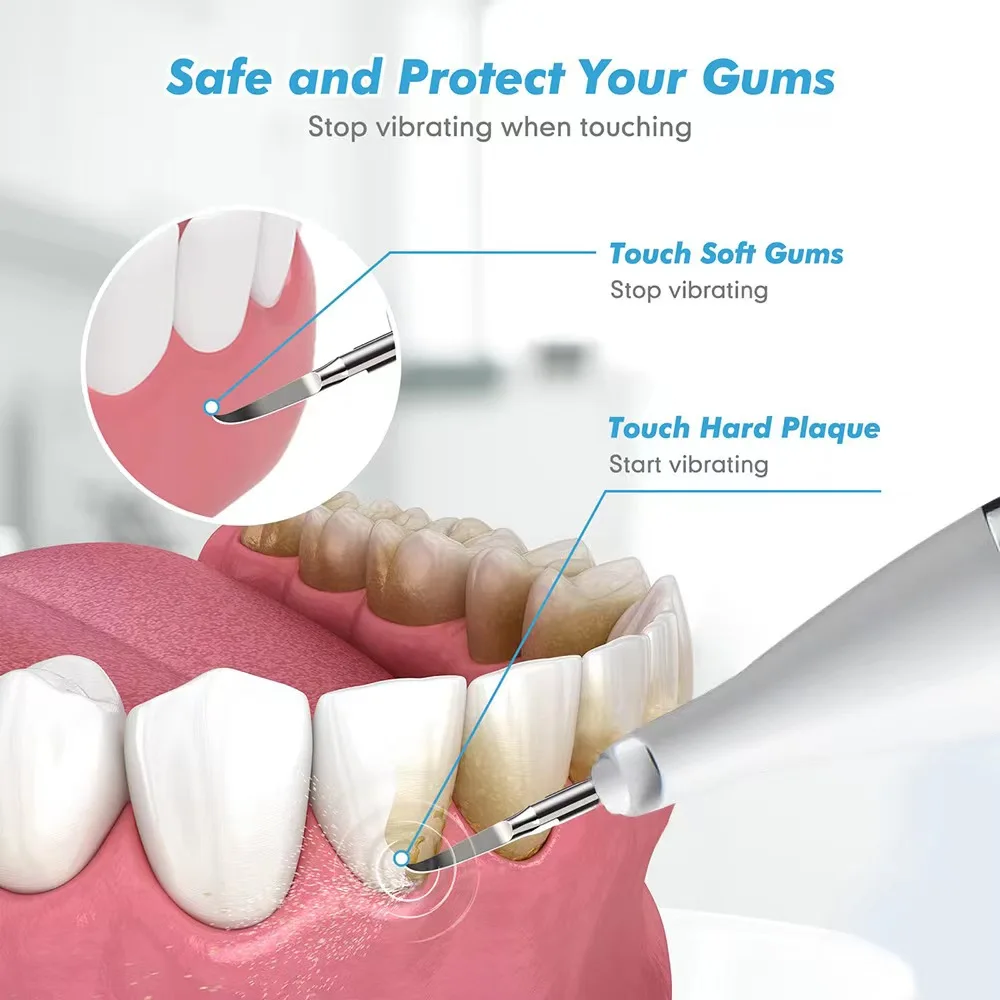 De Dentes, Limpar Tártaro, Manchas De Fumaça,