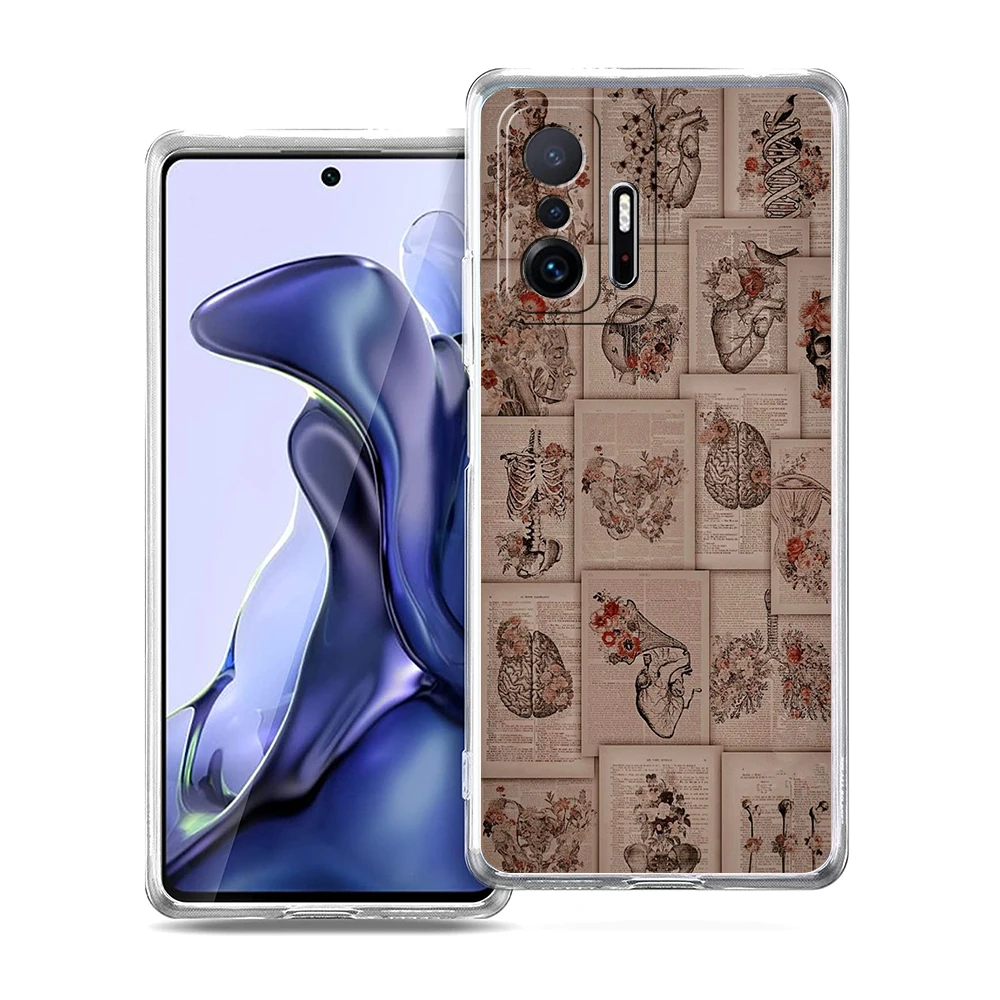 Transparent Soft TPU Shell with Anatomy Skeleton Chalkboard Heart Design