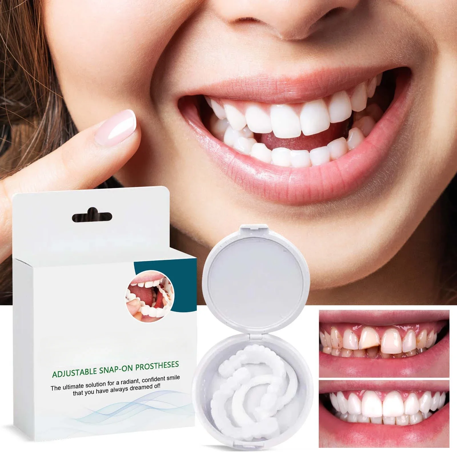 

Adjustable snap-on dentures Cosmetic teeth interdental braces orthodontic denture kits for women and men