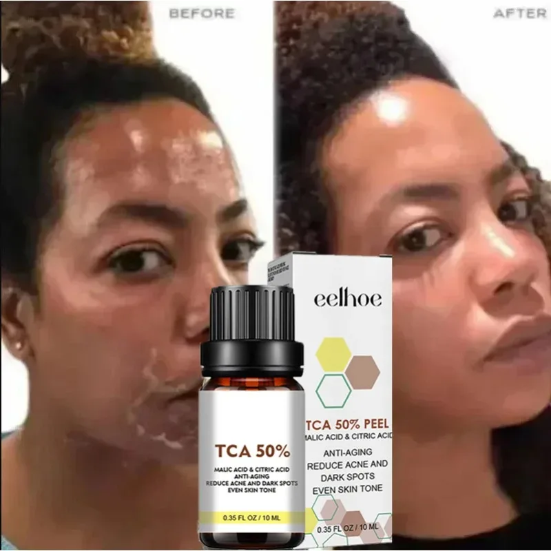 Salicylic acid facial serum Salicylic Acid Face Facial Peel Neutraliser Face Deep At Home Chemical Peel Exfoliate Refine skin care serum