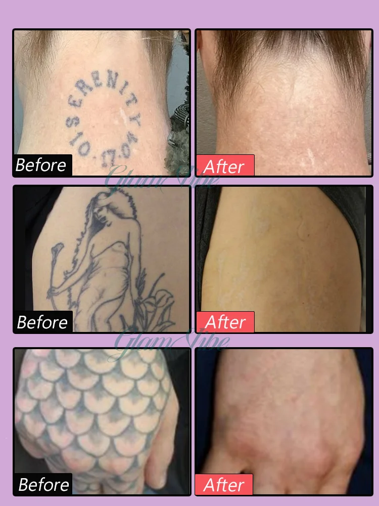 Slide image 041f96f545ce49eabed5dd471489a57e