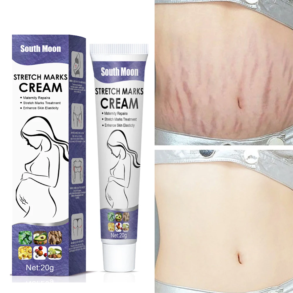 

Strech Marks Permanent Removal Cream Crema Para Estrias Blancas Eliminar Grossesse Maternité Femme Vergeture Traitement Puissant