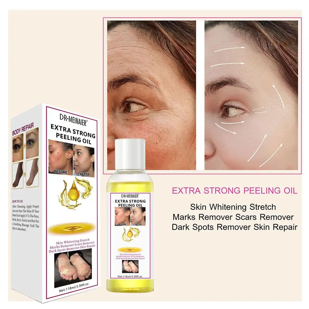 

Yellow Peeling Oil Strong Yellow Peeling Oil Lighten And Even Hands Elbows Skin Tone Whiten Skin Knees C0R8