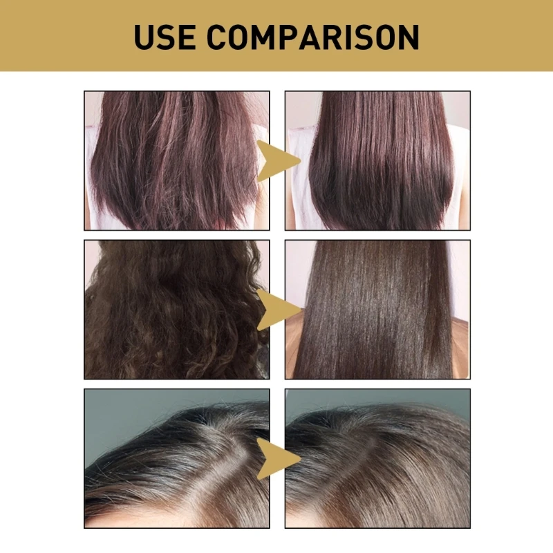 

E1YE Имбирный шампунь против выпадения волос, лечение кожи головы, глубокая очистка, против перхоти, зуда