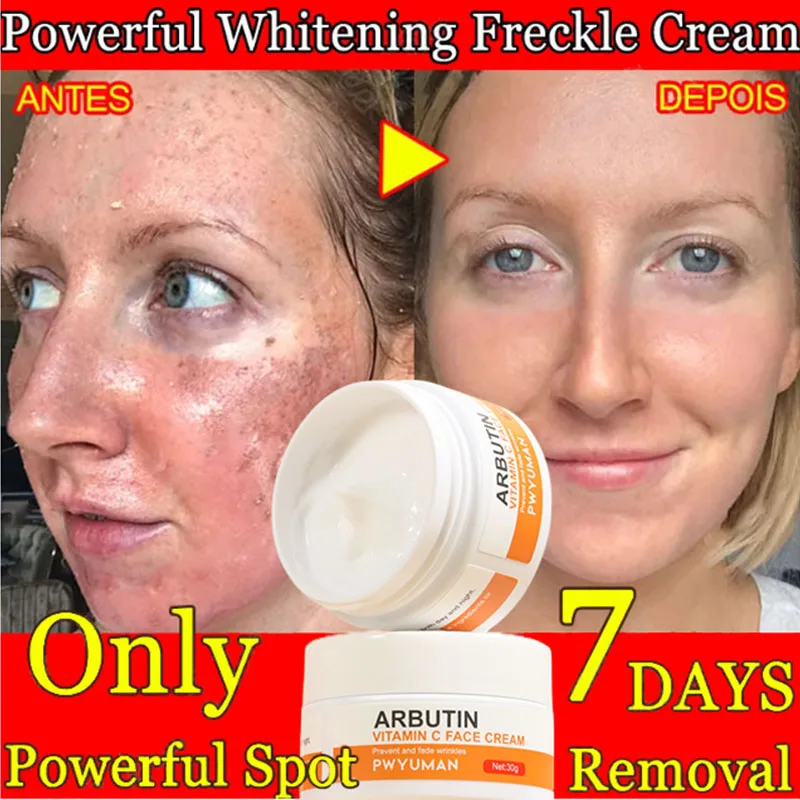 

Vitamin C Face Cream Skin Care Pigment Spots Freckles Remover Whitening Moisturizing Anit-Aging Cosmetics Korean Beauty Health