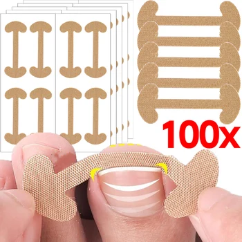 20-100pcs Adesivo per unghia del piede Patch per la correzione delle unghie dei piedi incarnite Adesivo per il correttore del piede Pedicure Strumenti sanitari Cuscinetto per il trattamento delle dita dei piedi 1